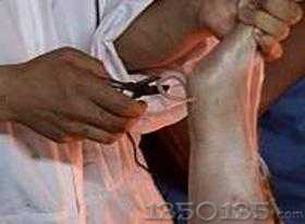 ����ʧ���iβ��